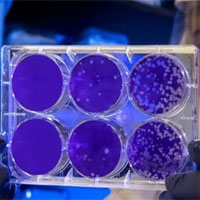 Phát hiện ra vi khuẩn có thể ăn kim loại độc hại trong nước, xử lý được nước thải công nghiệp