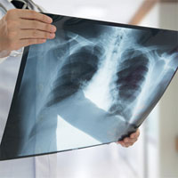 Chế tạo thành công thiết bị dò tia X mỏng nhất thế giới