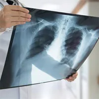 Chế tạo thành công thiết bị dò tia X mỏng nhất thế giới