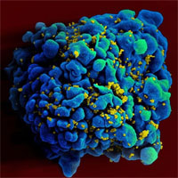 Phát hiện người thứ hai trên thế giới tự khỏi HIV