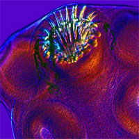 Người đàn ông co giật vì khối u não, hóa ra đây là hậu quả của bữa ăn nhiều năm về trước