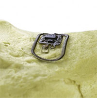 Thiết bị không dây theo dõi sức khỏe xương