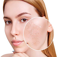 Cách điều trị da khô và thường nứt nẻ vào mùa lạnh