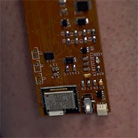 Băng gạc thông minh giúp bệnh nhân hồi phục từ xa