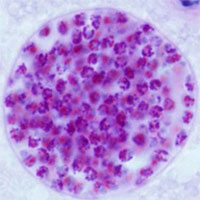 Những loại ký sinh trùng kỳ lạ nhất trong thế giới động vật