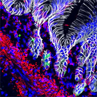 Dạ dày mini có thể tiết axit trong phòng thí nghiệm