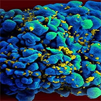 Vaccine mARN ngăn HIV cho kết quả tốt ở động vật