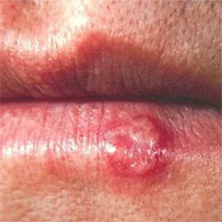 Sau 8 tiếng, loại virus này sẽ chui vào não và nó sẽ trở thành bất tử