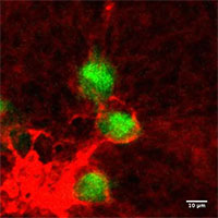 Vì sao các tế bào ung thư bất ngờ trỗi dậy?