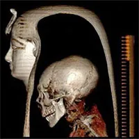Ai Cập tiết lộ chân dung Pharaoh cổ đại nhờ công nghệ tiên tiến