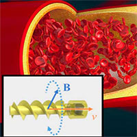 Robot xoắn ốc bơi trong mạch máu để phá máu đông