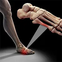 Tại sao người châu Á chỉ có 204 chiếc xương trong khi người Châu Âu và Châu Mỹ có đến 206 chiếc?