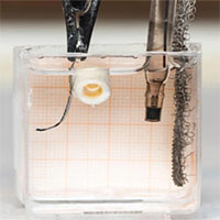 Robot tí hon giúp vá lành xương gãy trong cơ thể