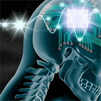 Công ty của Elon Musk chuẩn bị cấy ghép chip vào não người để 