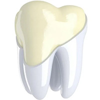 Bước tiến mới trong phát triển vật liệu điều trị nha khoa