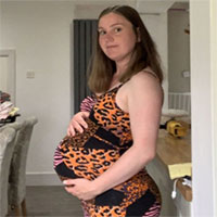 Căn bệnh lạ khiến người mẹ bị nổi dị ứng với chính đứa con của mình