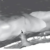 Phát hiện bộ phận cơ thể người chưa từng biết: 