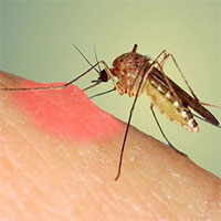 Nên làm gì khi trẻ bị nổi nốt đỏ như muỗi đốt?