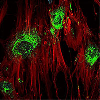 Sóng âm tần số cao biến tế bào gốc thành tế bào xương chỉ trong 5 ngày