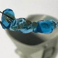 Loại Hydrogel mới giúp làm sạch bỏ sỏi thận trong cơ thể