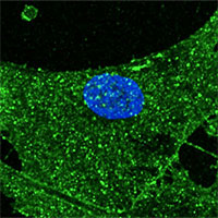 Biến da người phụ nữ 53 thành 23 tuổi nhờ kỹ thuật nhân bản cừu Dolly