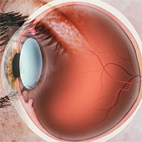 Tại sao các nhà khoa học từng nghĩ rằng võng mạc của người chết là nơi lưu giữ ký ức?