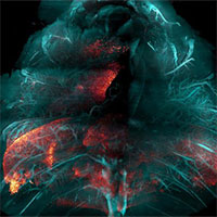 Kỹ thuật HYBRiD làm mô trong suốt: Tăng tốc nghiên cứu nhiều bệnh trong tương lai