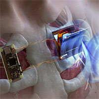 Nghiên cứu mới giúp sạc pin máy tạo nhịp tim mà không cần phẫu thuật