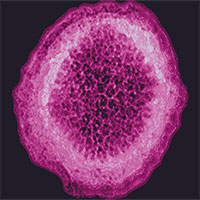 Virus bí ẩn gây viêm gan lan ra 11 nước, ca đầu tiên tử vong