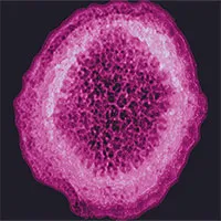Virus bí ẩn gây viêm gan lan ra 11 nước, ca đầu tiên tử vong