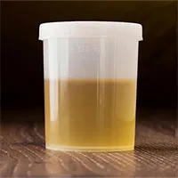 Sự thật gây sốc: Người La Mã cổ đại đánh răng bằng nước tiểu