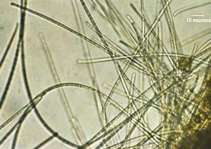 Vi khuẩn biển có thể tạo ra nguồn năng lượng thân thiện với môi trường