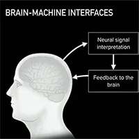 Neuralink là gì? Neuralink có "chữa" được ù tai như Elon Musk tuyên bố không?