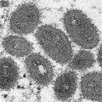 Đức khuyến cáo cách ly F1 và F0 ít nhất 21 ngày đối với bệnh đậu mùa khỉ