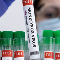 Bộ Y tế hướng dẫn các biện pháp phòng, chống tạm thời với bệnh đậu mùa khỉ