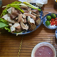 Lý do bất ngờ khiến người gầy vẫn bị gan nhiễm mỡ