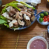 Lý do bất ngờ khiến người gầy vẫn bị gan nhiễm mỡ