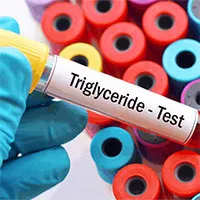Chỉ số Triglyceride là gì?