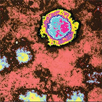 Loại virus hiếm gây tử vong gần 100% bất ngờ