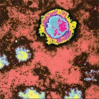 Loại virus hiếm gây tử vong gần 100% bất ngờ "tái xuất"