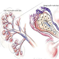 Dấu hiệu nhận biết sớm ung thư tuyến nước bọt