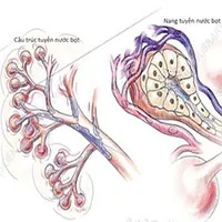 Dấu hiệu nhận biết sớm ung thư tuyến nước bọt