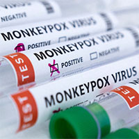 WHO phát hiện virus gây bệnh đậu mùa khỉ trong tinh dịch của bệnh nhân