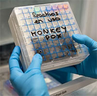 WHO họp khẩn, cân nhắc đậu mùa khỉ là tình trạng khẩn cấp toàn cầu