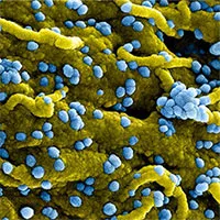 WHO tuyên bố đợt bùng phát loại virus mới