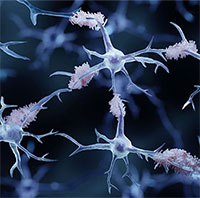 Truyền máu sẽ mở ra một hy vọng mới trong việc điều trị bệnh Alzheimer