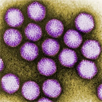 Làn sóng viêm gan bí ẩn khiến hơn 1.000 trẻ mắc đã có lời giải