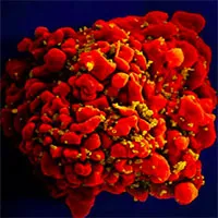 Bệnh nhân lớn tuổi nhất được chữa khỏi HIV