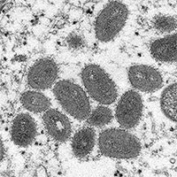 Chủng virus đậu mùa khỉ ở Ấn Độ khác với chủng ở châu Âu