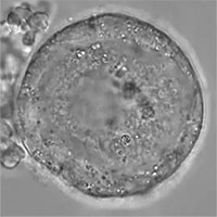 Tế bào trứng của con người có thể tồn tại đến 50 năm